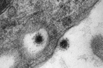 Koronavirüsün Delta Plus mutasyonu görüntülendi