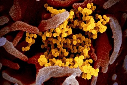 Omicron'u Güney Afrika'da ilk tespit eden doktor: Semptomlar olağan dışı ama hafif