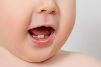 Sağlıklı gülüşler bebeklikten başlıyor!