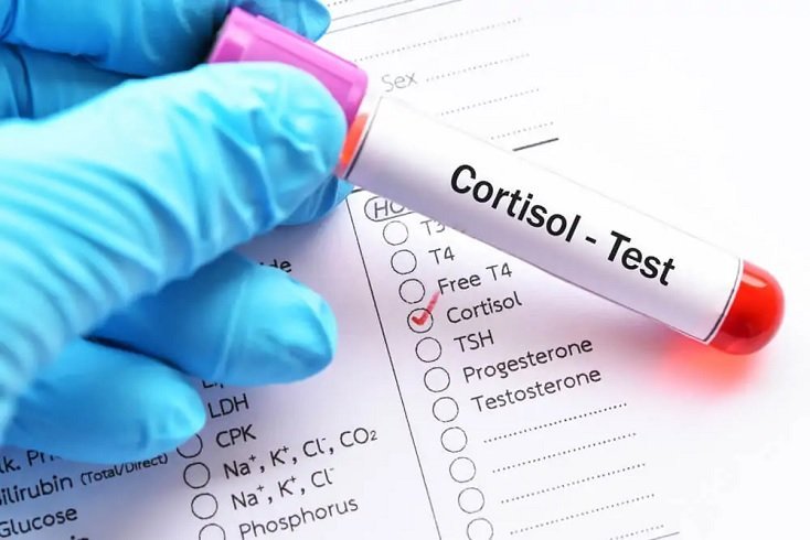 Kortizol Nedir? Kortizol Hormonu Ne İşe Yarar? Kortizol Nedir? Kortizol Hormonu Ne İşe Yarar?