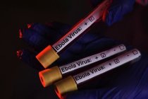 Dünya Sağlık Örgütü'nden Ebola salgını uyarısı: Can kaybı 3 bin 500'ü aştı