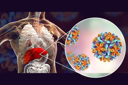 Hepatit sinsi ilerleyebiliyor! Hepatit hastaları bunlara dikkat etmeli?